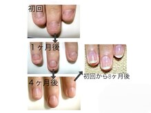 レヴィア(Revia)/深爪ケア