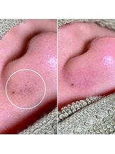 美眉アンド美肌専門サロンすみれ/ビフォーアフター