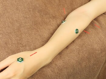 サンクエール 代官山鍼灸院(CINQ AILES)/鍼灸施術