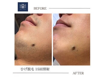 メンズメイド(Mens'Made)