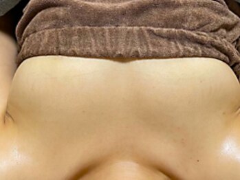 エミニナル(EMININAL)の写真/もう無理かも…と諦めないで！骨格調整マッサージ＋コラーゲン生成&バージスライン形成2台のマシンで豊胸♪