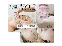 スキンハピネス(skinhappiness)の雰囲気（沖縄特有の紫外線の強さにも負けない★お肌の土台作り）