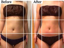 ムーロ(muro.)/Before &nbsp;After