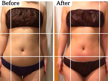 ムーロ(muro.)/Before After