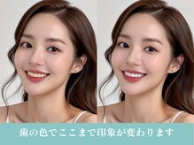 ジュエルホワイトニング/歯の色で印象変わります！