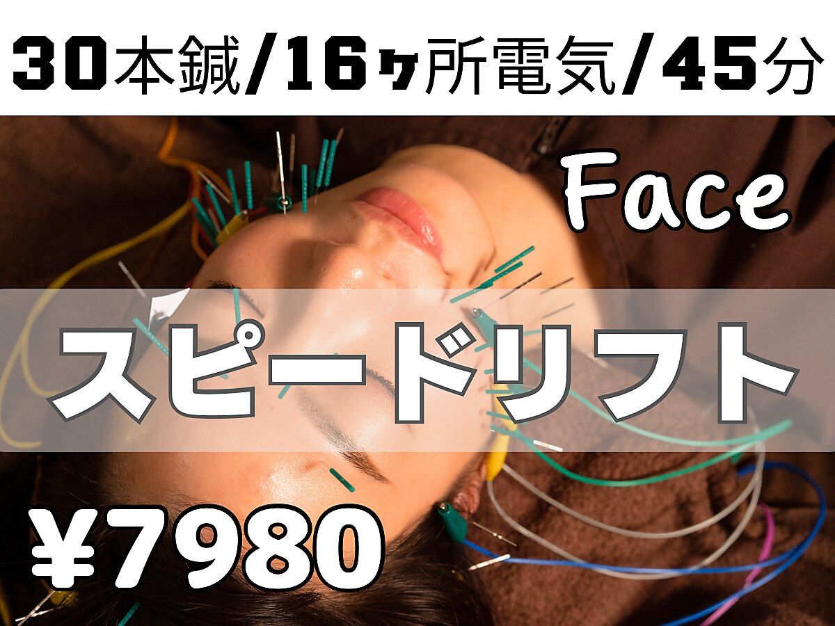 【スピードリフトコース（お顔の美容鍼）45分】の予約クーポン