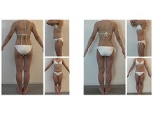 ミネルバエンダモロジー/エンダモロジー/痩身/ウェルネス