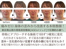 スフレ(souffle)の雰囲気（面長改善・エラ・左右差改善、歪みに特化した骨格調整で根本改善）