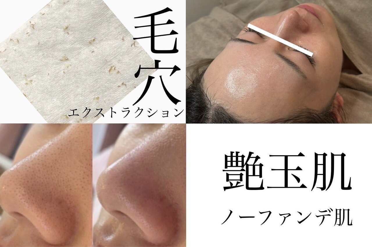 3月限定【韓国肌管理】セルマン/毛穴エクストラクション\31900→\16500