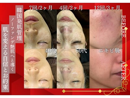 シェリートーキョー 成田店(Cherie Tokyo)の写真