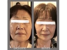 ナルエステティック(NARU.esthetic)の雰囲気（本気で変わりたい方のたるみ改善サロンです。45才～60代に人気）