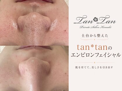 プライベートサロン タンタン(tantan)の写真