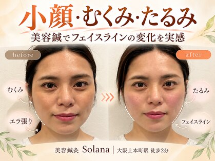 ソラナ(Solana)の写真