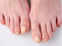 ネイルサロン ビホー/フットネイル☆