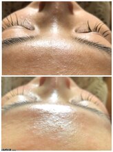 レイヘアー(LEI hair)/お顔ワックス