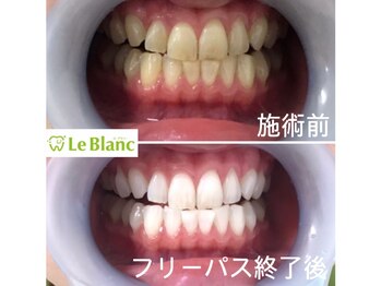 ルブラン 奈良店(Le Blanc)/Smile！！33000円 ！