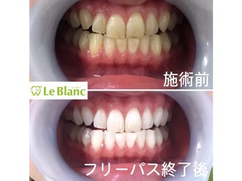 ルブラン 奈良店(Le Blanc)/Smile!!33000円 !