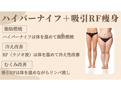 トータルエステティックサロン ヴィーナス(Venus)の写真