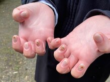 ココ(KOKO)/両手アート2本ずつ¥5000