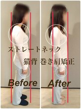 ティーエスエル とがし整体ラボ(TSL とがし整体 Labo)/姿勢矯正・猫背 巻き肩/美容整体