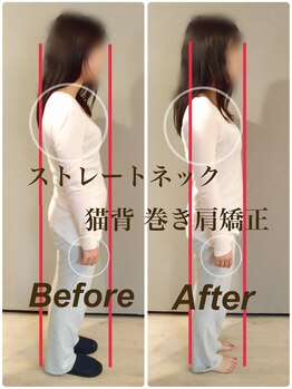 ティーエスエル とがし整体ラボ(TSL とがし整体 Labo)/姿勢矯正・猫背 巻き肩/美容整体