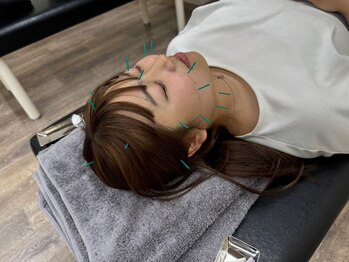 いとしまリハキュア整骨院の写真/お顔の様々なお悩みに◎小顔効果絶大★短期間で効果を感じたい方に◎