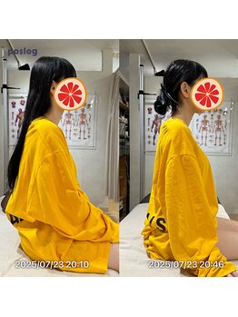 グレフル鍼灸接骨院 整体院 心斎橋/整体/肩こり/マッサージ/腰痛