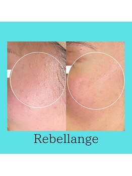 レヴェランジュ(Rebellange)/