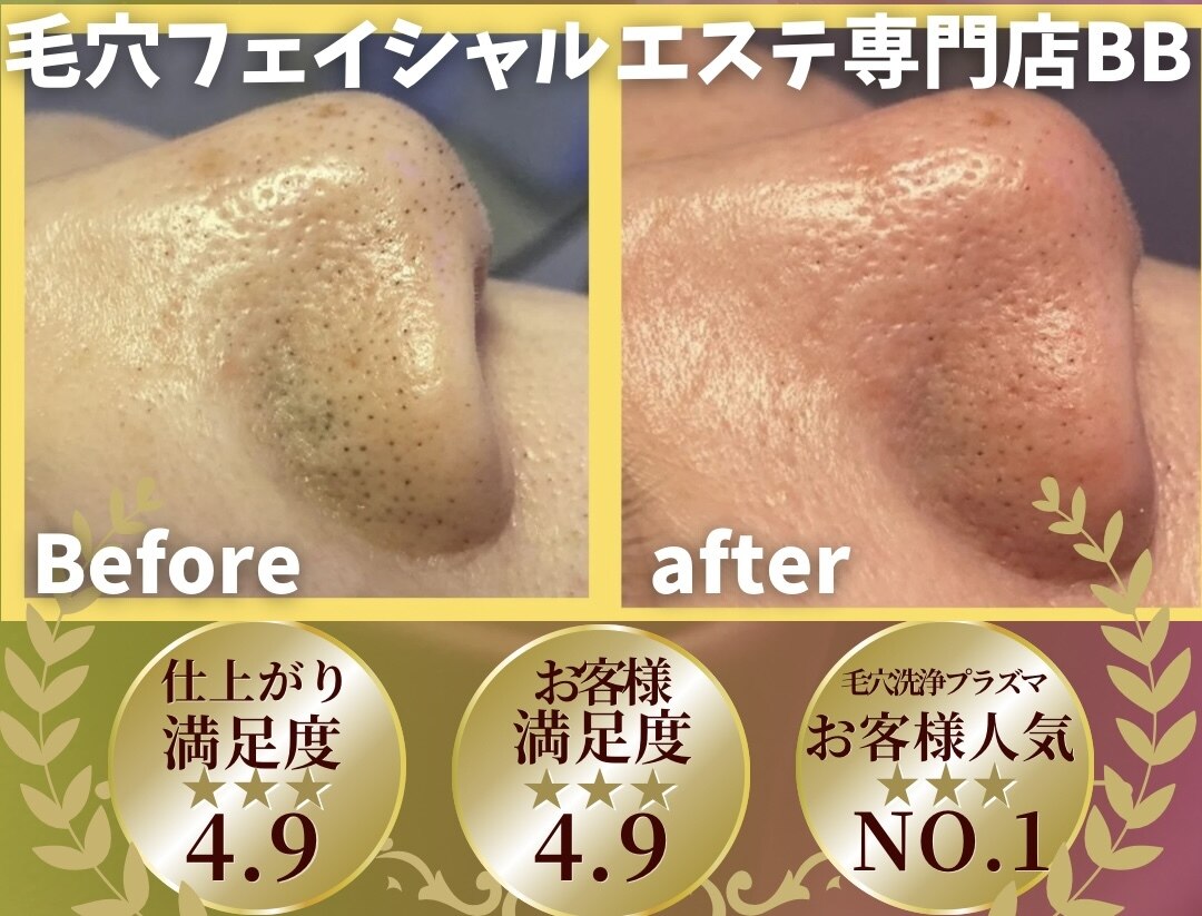 ビービー(BB)｜ホットペッパービューティー