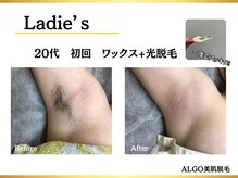 アルゴ 豊中岡町駅前店(ALGO)の雰囲気（【結果重視で効果が早い】ワックス×光で即日ツルツル仕上がり☆）