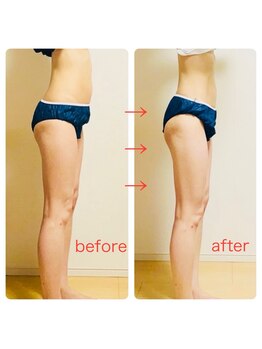 ヨサパーク ハロ(YOSA PARK Haro)の写真/パンパンの足・セル脂肪を撃退★夏の肌見せに自信を！美脚を叶えるリンパマッサージ×ルルオンで速攻細見え