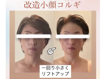 ソワ(sowa)の写真/たるみケアで整うお肌。ほうれい線やたるみ改善を目指す癒しの時間を★