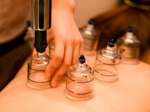 たかさき整骨院/カッピング