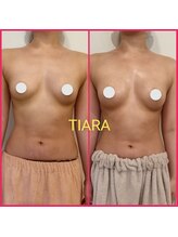 ティアラ(TIARA)/インスタ【@takara_tiara】