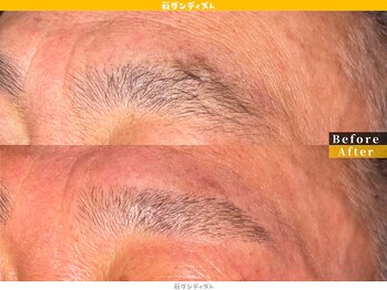 眉ダンディズム 大阪天神橋六丁目店/幅広い年齢層に特化した眉サロン