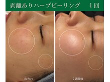 アンナビューティ 六本木 乃木坂店(Anna Beauty)の雰囲気（結果重視の肌質改善サロン・お客様のお悩み別メニューをご提案）