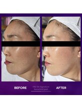 オスマンティエ(Osmantier)/バクチオールピール