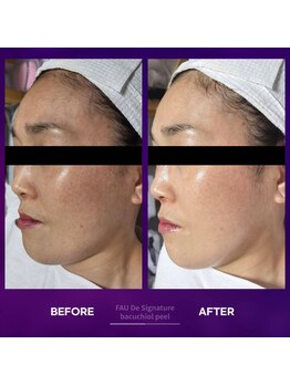 オスマンティエ(Osmantier)/バクチオールピール