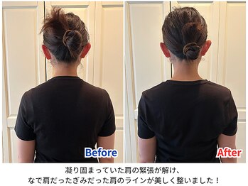 ラシュシュ/ビフォーアフター