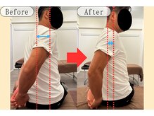 シェアハピネス たまプラーザ(share happiness)/Before＆After