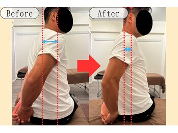 シェアハピネス たまプラーザ(share happiness)/Before＆After