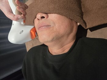 クローバー(clover)の写真/【メンズ脱毛】濃いヒゲ/太い毛もIPLで徹底照射！3週間に1回のスピード脱毛◎最終21時受付で仕事帰りもOK☆