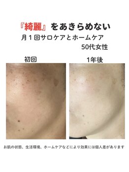 ダーウィン(Darwin)/40代からの美肌ケア