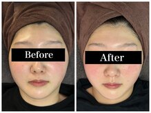 フェリーチェ 海老名(Felice)/フェイシャルBA