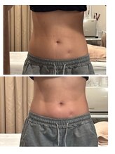 白美/韓国REDSHOT(レッドショット)