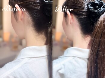 ピミル(PIMIL)/うなじ脱毛