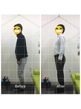 ナオル整体 太田院(NAORU整体)の写真/デスクワークによる肩こり・首こり・腰痛に。AI姿勢診断で原因を分析し、根本改善を目指します。