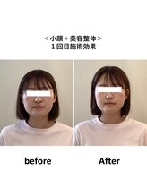 ぷめはな整体/美容整体+小顔矯正