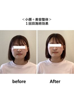 ぷめはな整体/美容整体+小顔矯正