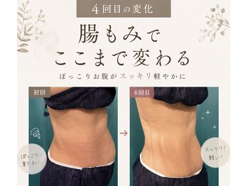 ページミューの写真/【リピーター多数◎】自律神経の乱れによる不調に！痛みの少ない「腸もみ」で心身ともにスッキリ軽やかに♪